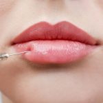 Magnificence：4 Most Fashionable Lip Fillers that Make Your Pout Final Actually Lengthy